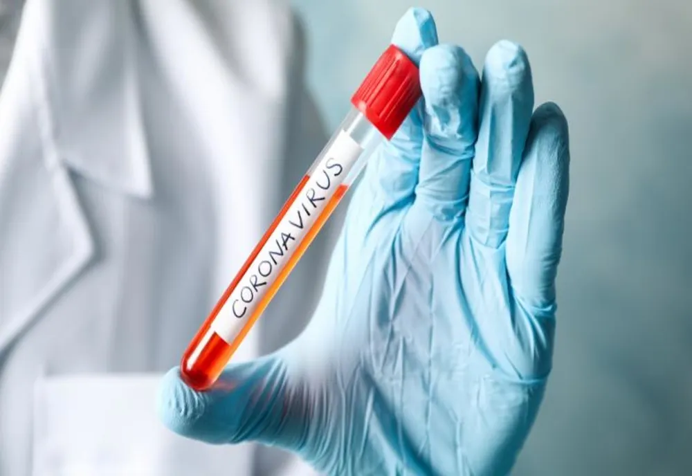 33 de cazuri de coronavirus în județul Alba. Oficial se fac mai multe anchete epidemiologice