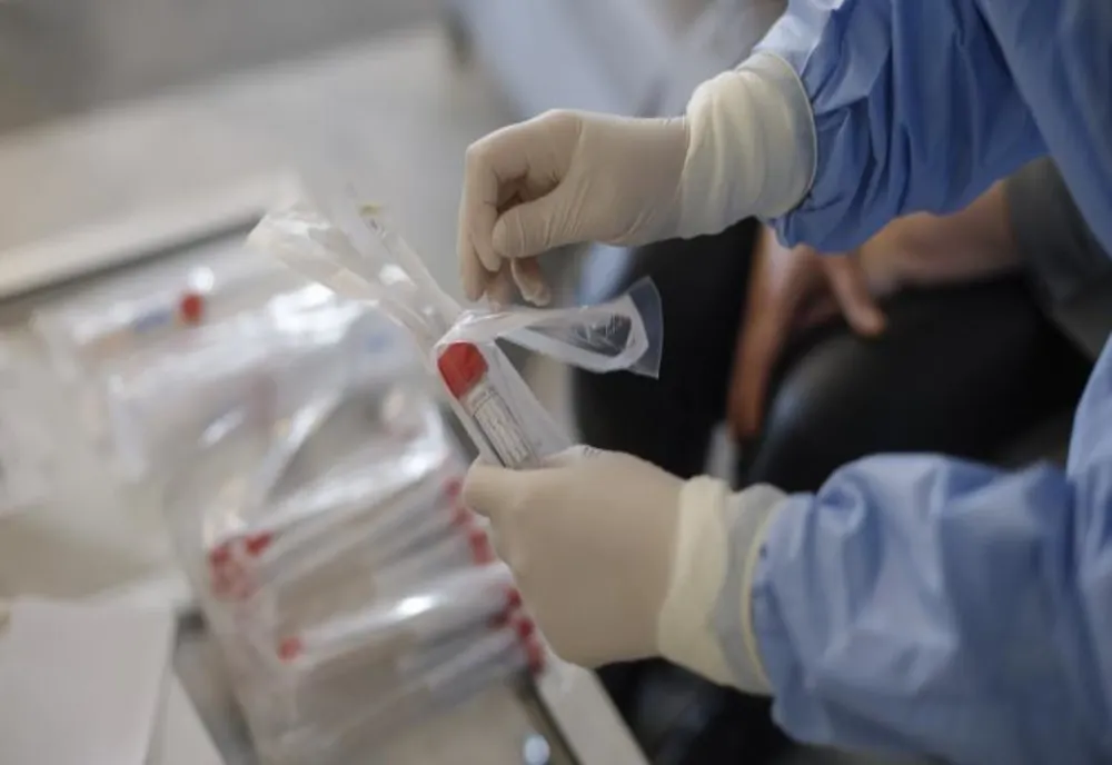 Focar de infecție cu  COVID-19 la o firmă de panificație din Alba Iulia. Autoritățile au demarat o anchetă epidemiologică