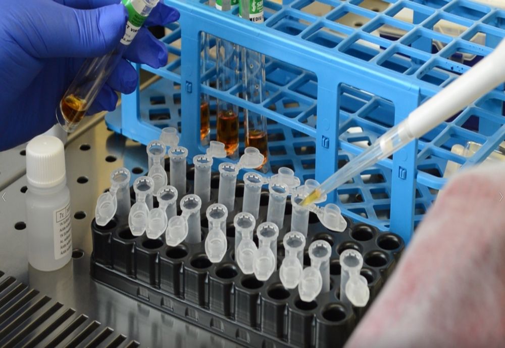 Aproape 300 de persoane de la Centrul de Dializă din Alba Iulia au fost testate. Patru cadre medicale și 10 pacienți depistați POZITIV cu COVID19