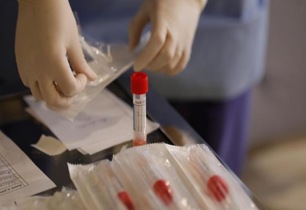 DSP Alba suspendă recoltarile pentru testele COVID