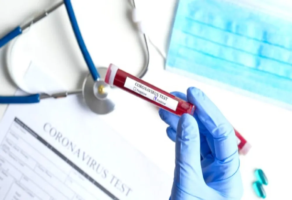Focar de coronavirus la Primăria Alba Iulia
