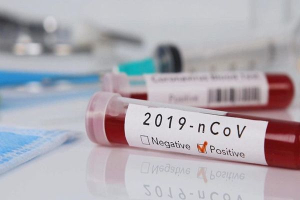 Coronavirus România: A crescut numărul celor infectați cu CoVid-19, la 762! Șase pacienți, în stare foarte gravă