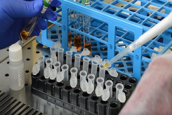 Aproape 300 de persoane de la Centrul de Dializă din Alba Iulia au fost testate. Patru cadre medicale și 10 pacienți depistați POZITIV cu COVID19