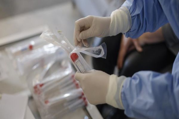 Focar de infecție cu  COVID-19 la o firmă de panificație din Alba Iulia. Autoritățile au demarat o anchetă epidemiologică