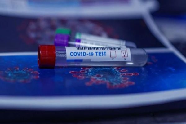 Bilanț coronavirus 21 august: 1.392 de cazuri noi, 42 de decese și 497 de persoane internate la ATI