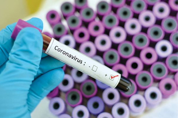 Bilanț coronavirus 18 august. Noile date oficiale: 1.014 cazuri noi și 45 de decese
