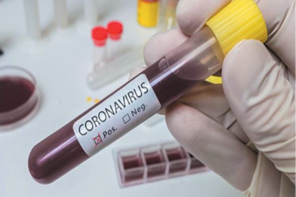 Bilanț coronavirus 28 august: 1.318 cazuri noi, 48 de decese și 497 persoane internate la Terapie Intensivă