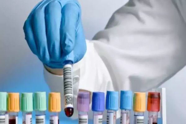 Cel mai mare studiu clinic al unui test de sânge care poate detectat 50 de tipuri de cancer, demarat în Marea Britanie