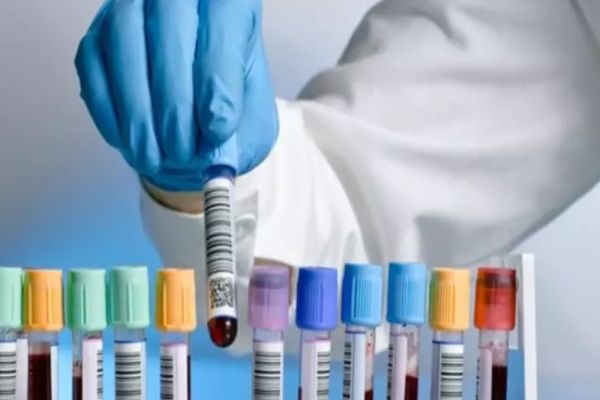 Tarifele ANALIZELOR MEDICALE, mai mari cu 60% față de anul trecut! Sănătate românilor devine un LUX