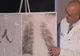 Un adolescent credea că are pneumonie, însă a avut nevoie de dublu transplant de plămâni. Medic: Nu am mai văzut așa ceva 