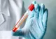 Raport INSP săptămâna 13-19 septembrie: 91.5% din decesele înregistrate au fost la persoane nevaccinate
